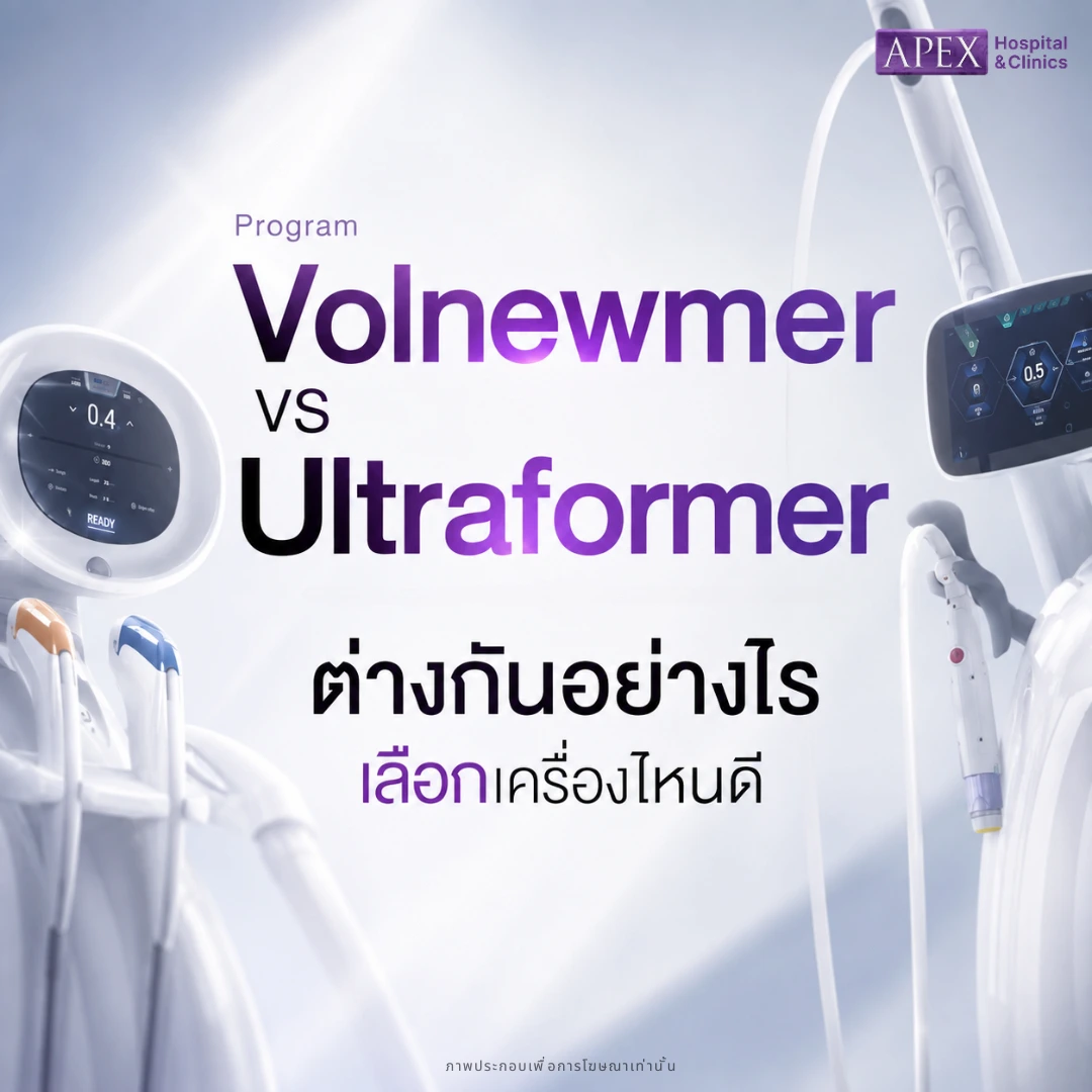 Volnewmer vs Ultraformer เลือกเครื่องไหนดี