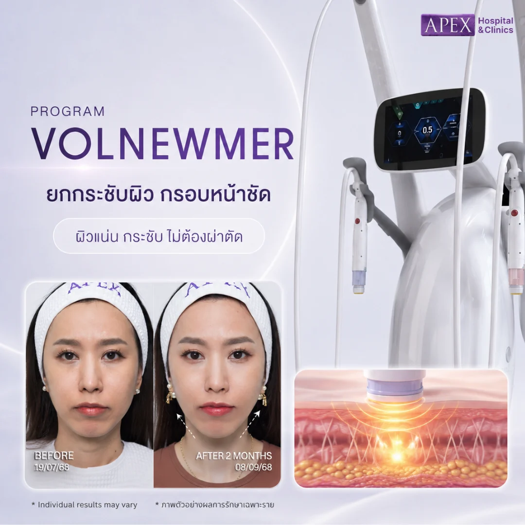Volnewmer
