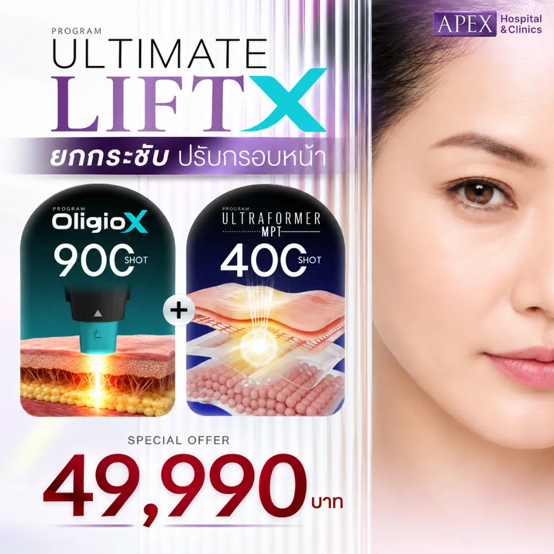 Oligio X 900 Shot ราคา