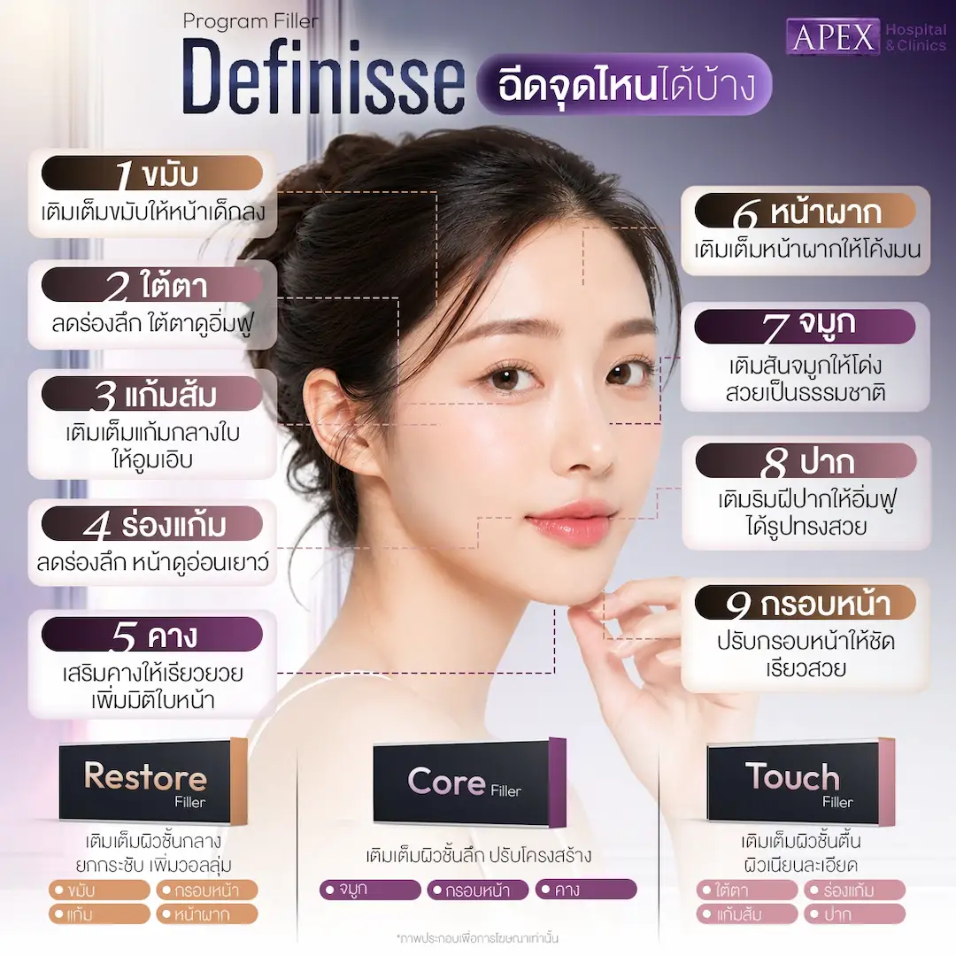 ฟิลเลอร์ Definisse ฉีดบริเวณไหนได้บ้าง