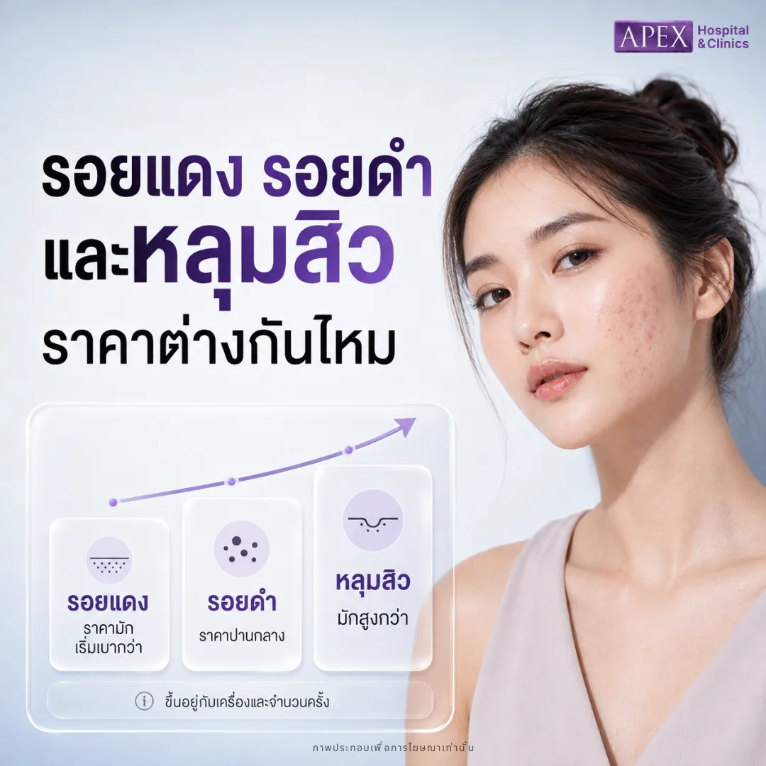 รอยแดง รอยดำ และหลุมสิว ราคาต่างกันไหม