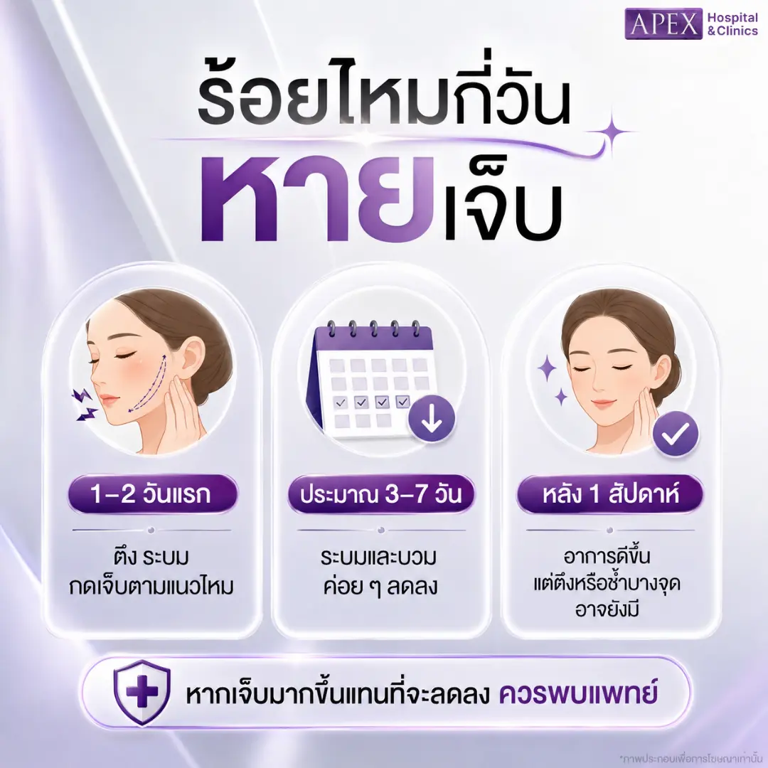 ร้อยไหมกี่วันหายเจ็บ