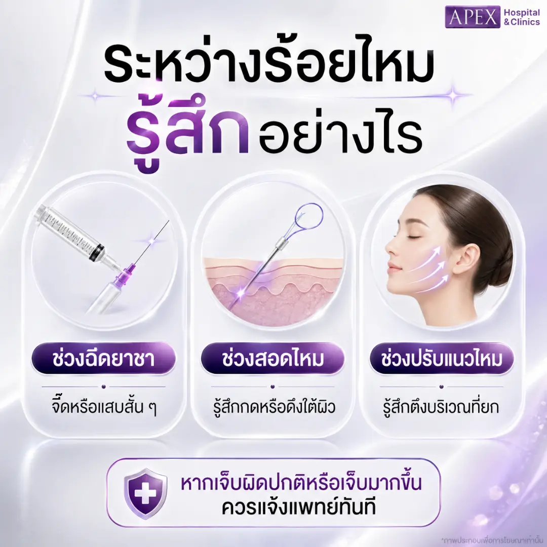 ร้อยไหมเจ็บมากไหม ระหว่างทำรู้สึกอย่างไร