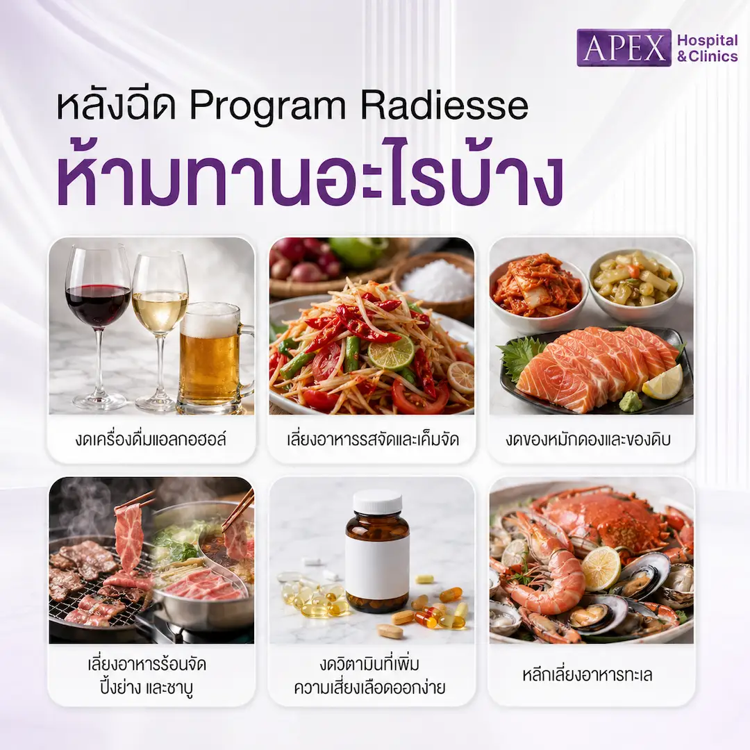 หลังฉีด Radiesse ห้ามทานอะไรบ้าง