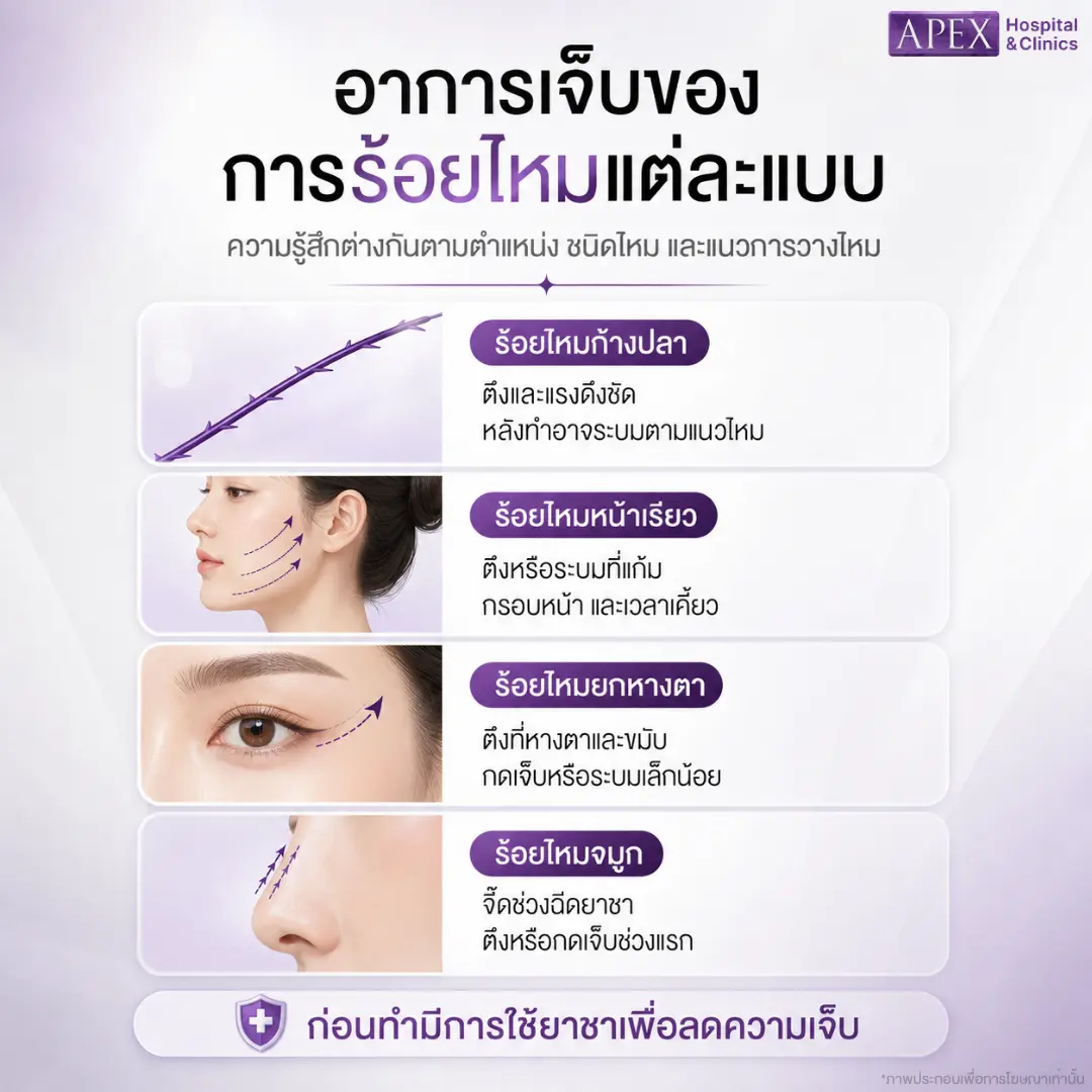 อาการเจ็บของการร้อยไหมแต่ละแบบ