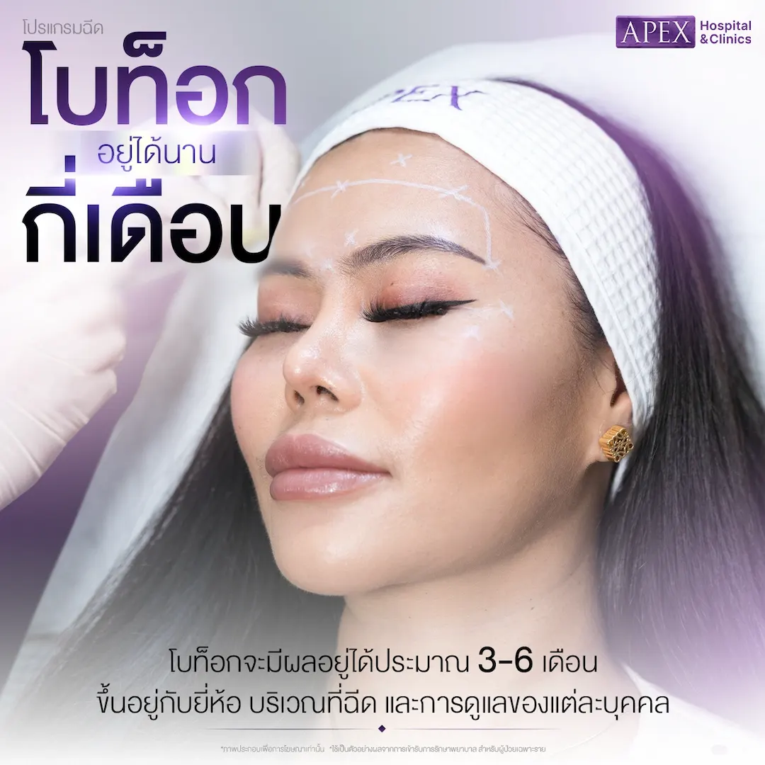 โบท็อกอยู่ได้นานกี่เดือน