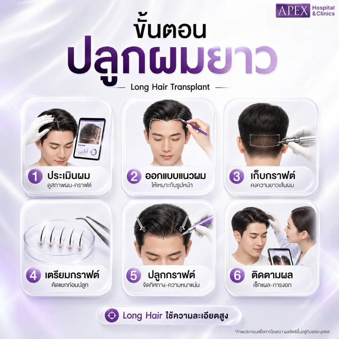ขั้นตอนการปลูกผมยาว