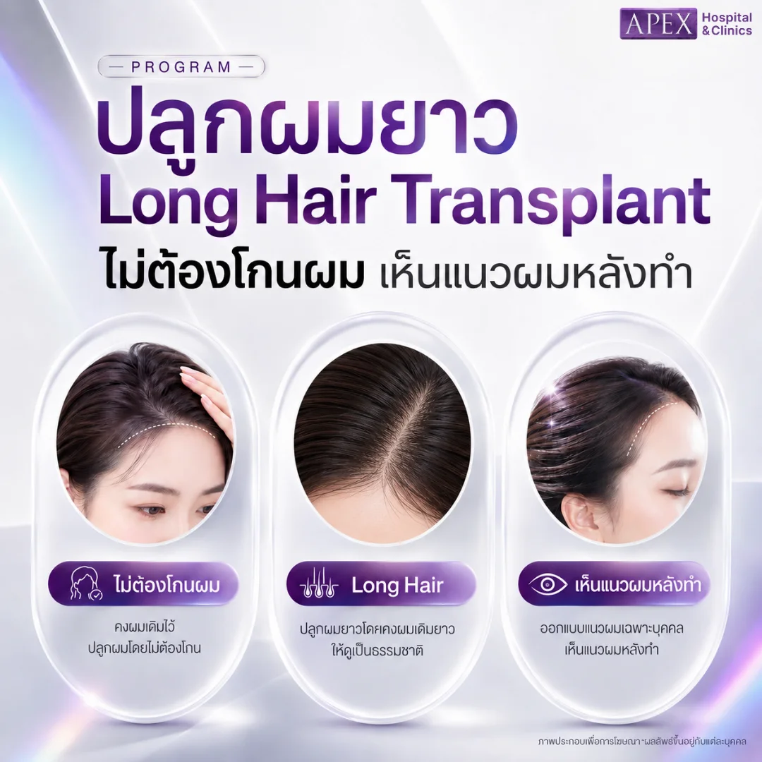 ปลูกผมยาว คืออะไร