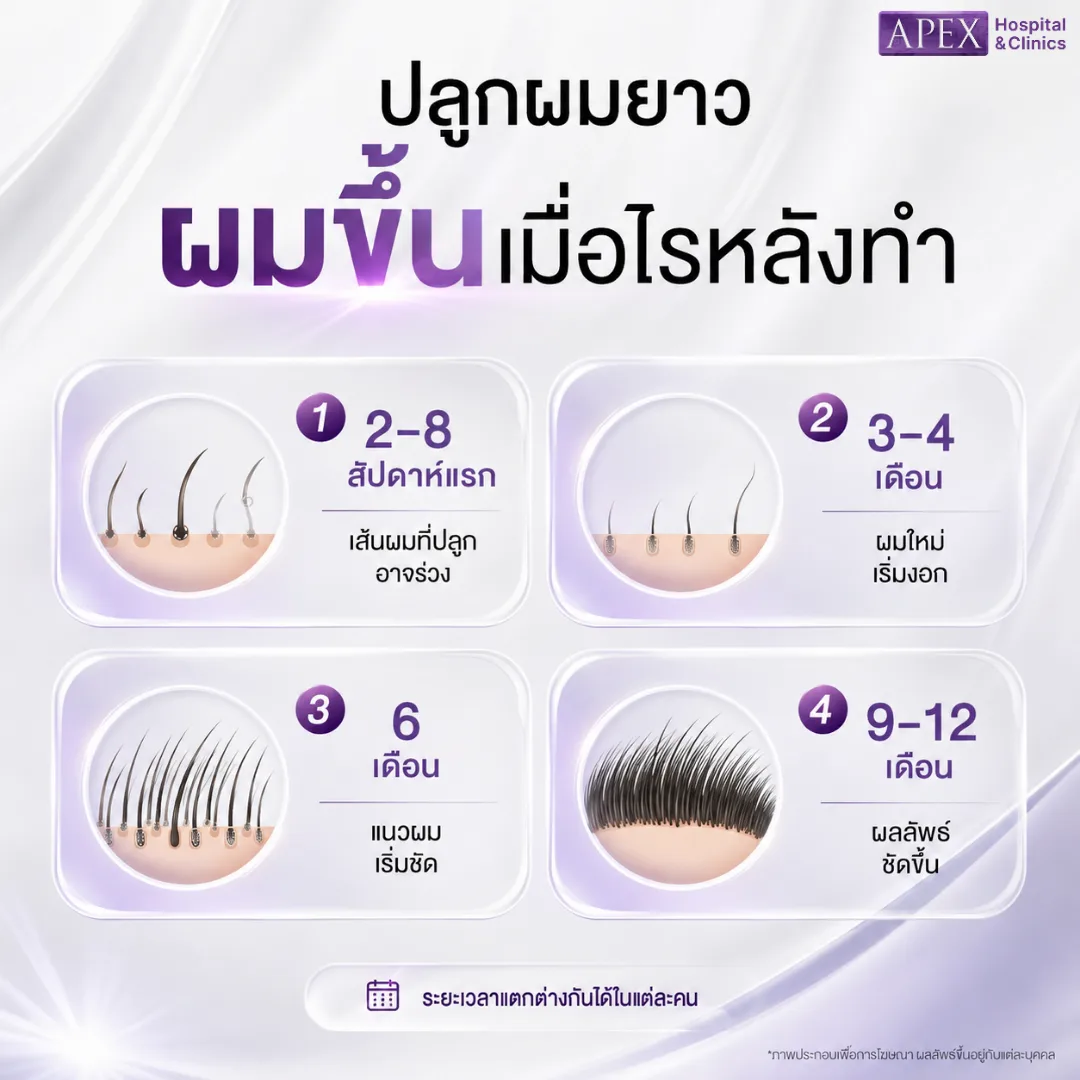 ปลูกผมยาว ผมขึ้นเมื่อไรหลังทำ