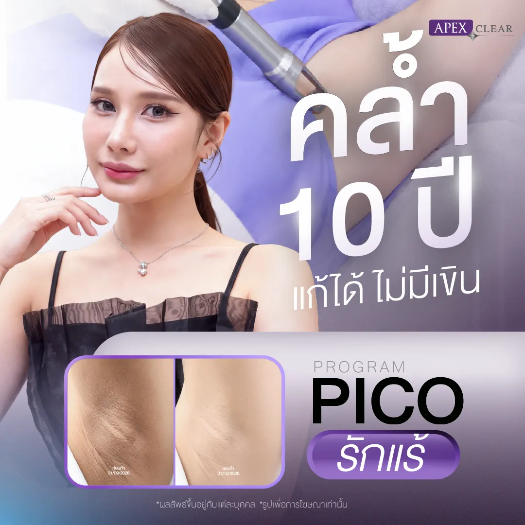 รีวิว เลเซอร์รักแร้ขาว Apex
