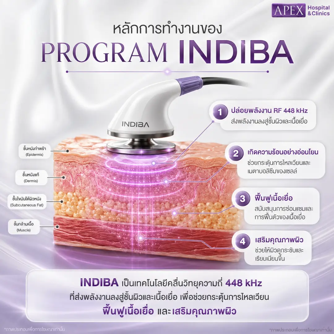 หลักการทำงานของ INDIBA
