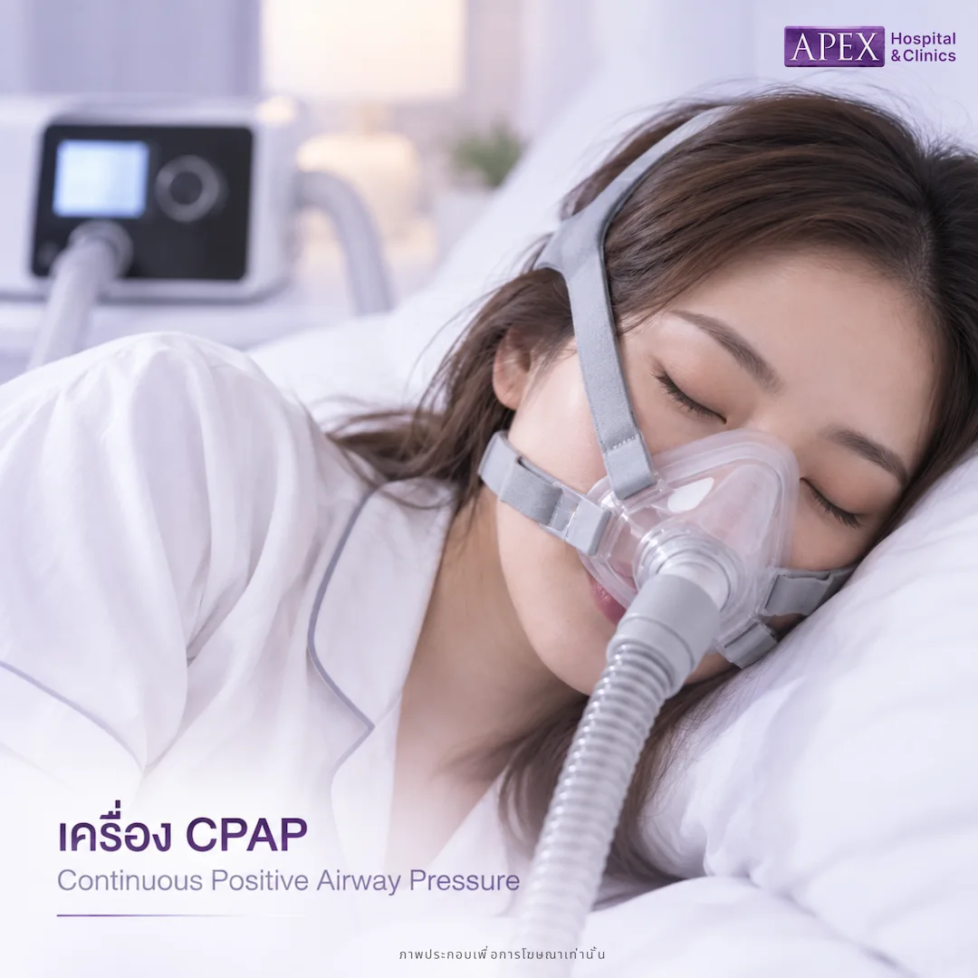 เครื่อง CPAP