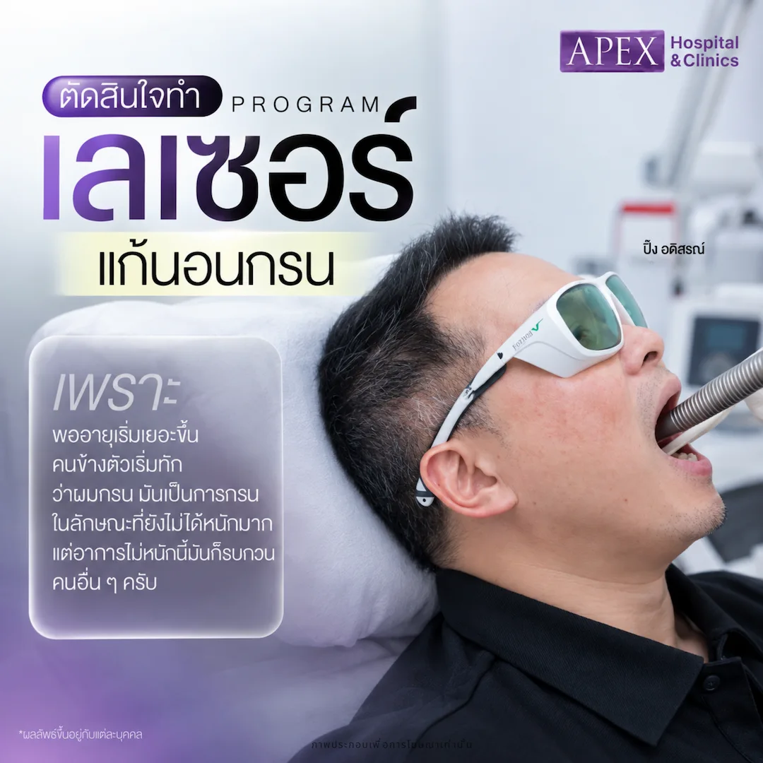 เลเซอร์นอนกรน